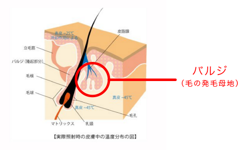 バルジ（毛の発毛母地）